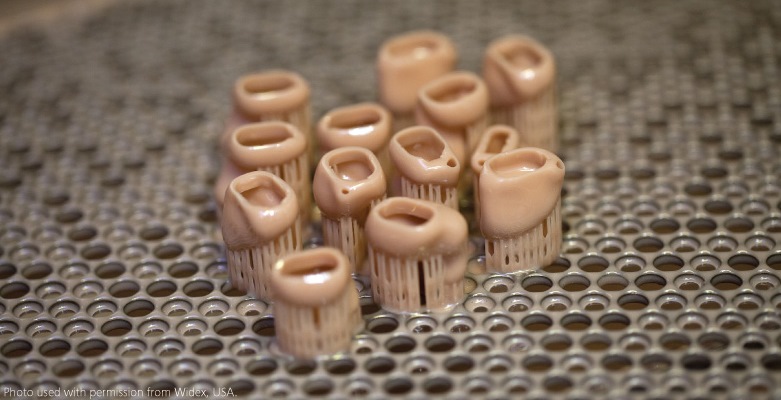 DUP_709_Figure3_Custom-hearing-aid-shell