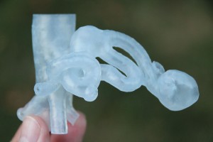 Image credit: Embodi3D website (http://www.embodi3d.com/blog/3/entry-173-saving-a-spleen-with-3d-printing-pre-surgical-planning-with-medical-models-make-impossible-surgeries-possible/)