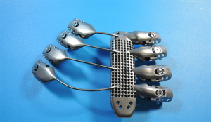 Front of 3D printed titanium sternum and ribs Image credit: CSIRO