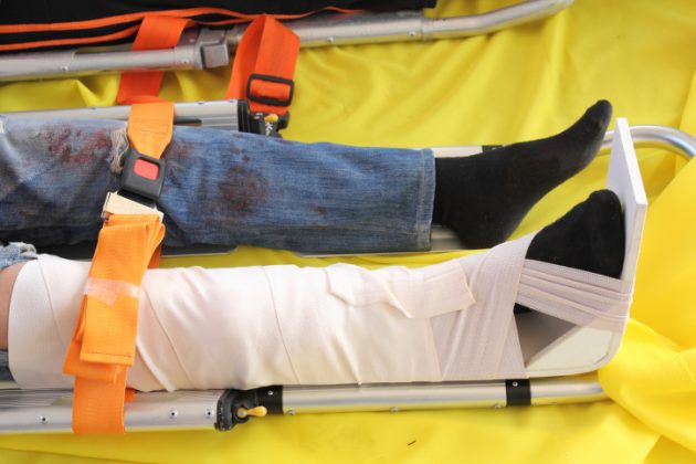 Compostable Splint Innovation at its best: revolutionary foldable splint to be ...