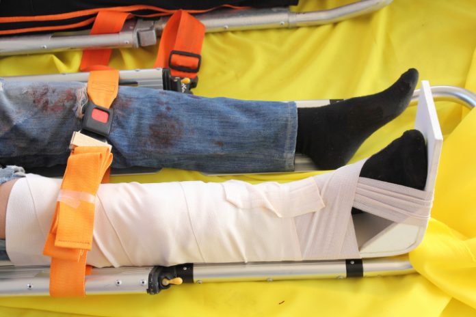 splint