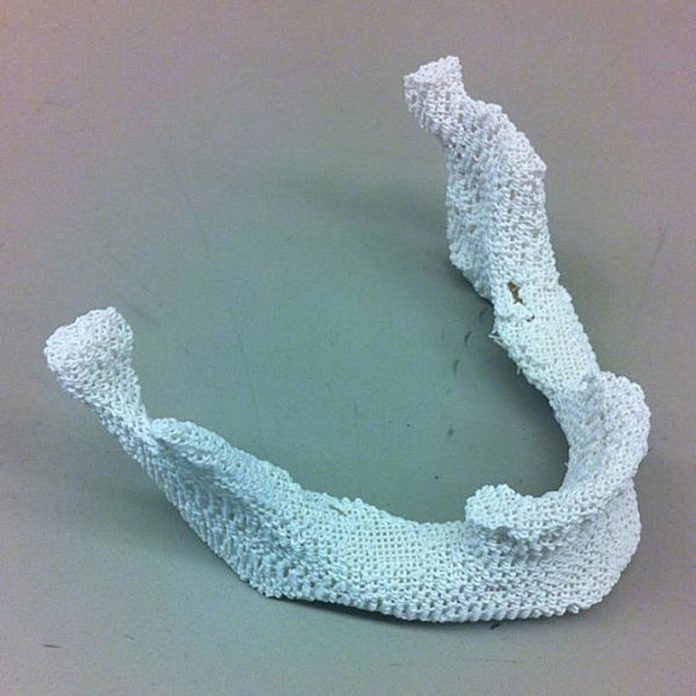 3d-printed-bone