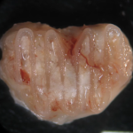 Irish researchers develop new process for 3D printing bone tissue