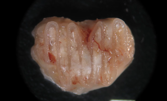 Bioprinted vertebral body