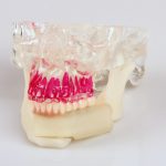 3D Systems introduces single-stage dental reconstruction technique that dramatically shortens recovery period (VIDEO)