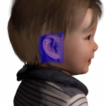 QUT and ‘Hear and Say’ charity team up to develop next-gen 3D printed prosthetic ears (VIDEO)