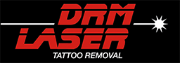 DRM Laser Tattoo Removal