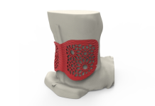 Stratasys 3D prints customised back brace to help Latvian wheelchair fencer overcome back issue at Rio Paralympic Games 2016
