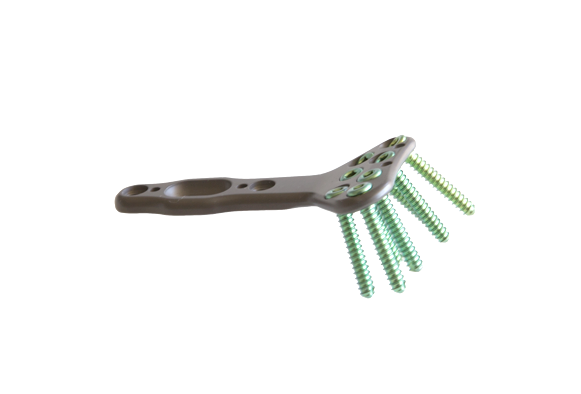 Plastico and Hackett Engineering
