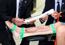 Qld surgeons successfully transplant 3D printed shinbone to save patient’s leg