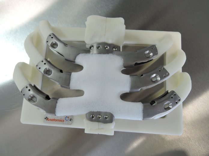 New York 2017 - 3D printed implant as shipped on its mount