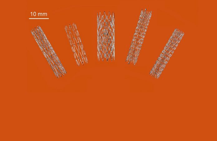 CSIRO Stents