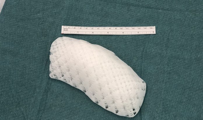 3d printed chest