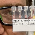 Monash develops breakthrough blood test that detects positive COVID result in 20 minutes