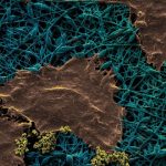 Aussie researchers develop next-gen wound dressing that detects infection and improves healing