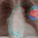 Nano-thin piezoelectrics advance self-powered electronics