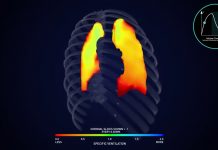 4DMedical-led joint venture granted $28.9M medical funding for new lung scanning tech