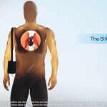 Monash, BiVACOR-led consortium to develop and commercialise world-first durable total artificial heart