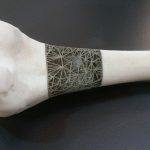 IMCRC industry partner Stryker to launch new Australian R&D facility RMIT_Bone1