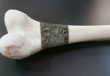 IMCRC industry partner Stryker to launch new Australian R&D facility RMIT_Bone1