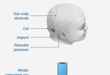 Cochlear-backed Aussie innovator raises $16m to test seizure epilepsy monitoring device