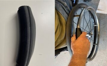 ARM Hub taps additive manufacturing in spinal cord injury tech dev’t