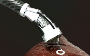 UNSW Sydney introduces newly developed 3D bioprinting surgical tool