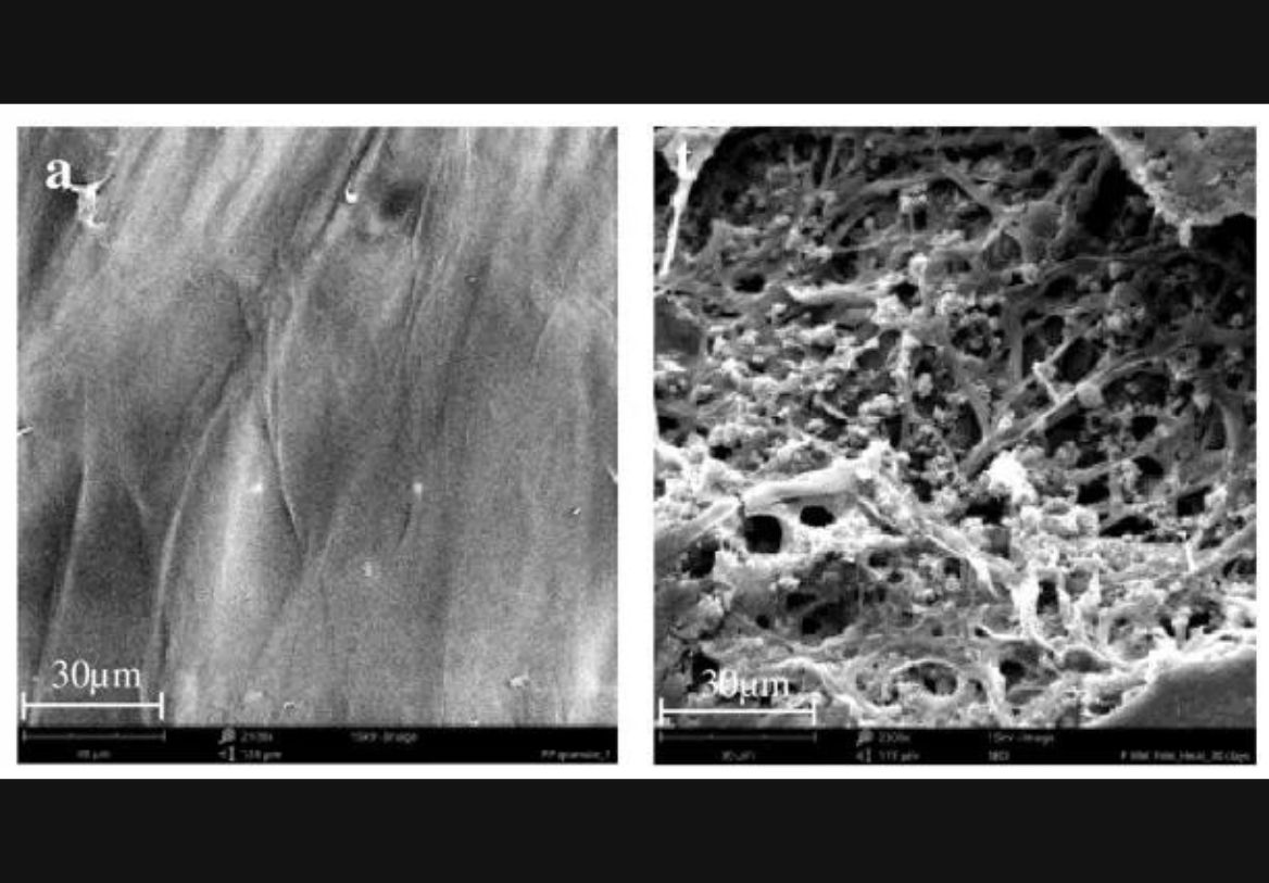Sydney University scientists discover plasticeating fungi Australian