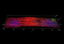 UW-Madison researchers unveil 3D-printed functional human brain tissue