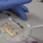 Queensland-designed tech developed for early detection of ovarian cancer