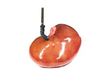 Electricity-free soft robot set to transform precision surgery